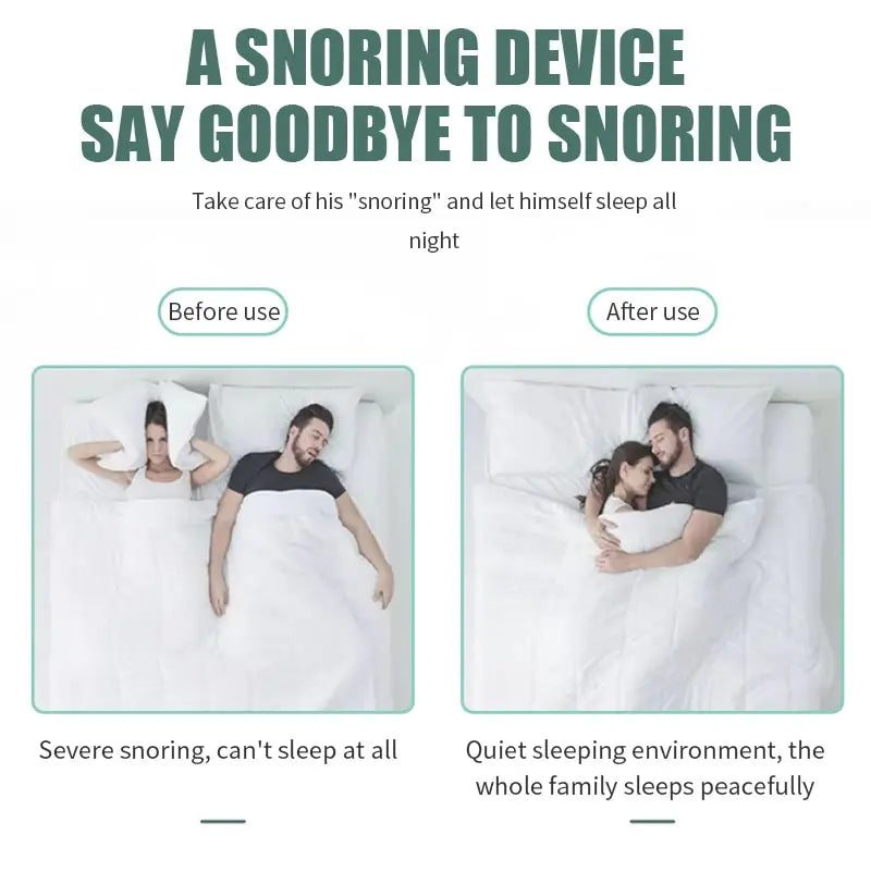 Anti-Snoring Devices